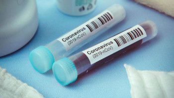 Фотография к новости: Павлодарда індетті анықтау үшін күніне 1500-ге жуық тестілеу өткізіледі