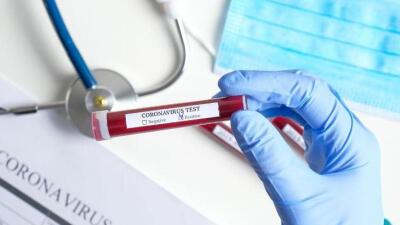42 адам коронавирус індетінен емделіп шықты