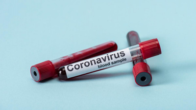 105 адам коронавирус індетінен емделіп шықты