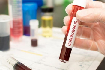 Фотография к новости: "Қазақмыстың" 133 қызметкері коронавирус жұқтырған