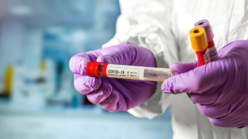 Фотография к новости: Өңірлерде вирус жұқтырғандардың дені ірі кәсіпорын қызметкерлері