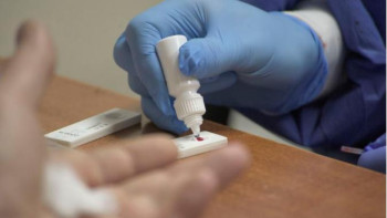 Фотография к новости: Елімізде карантин басталғалы бері 711 000 тест жасалды