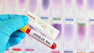 COVID-19. Инфекциясы бар науқастарды медициналық бақылау әдісі өзгерді