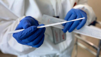 Фотография к новости: 64 инфекциялық ауруға мониторинг жүргізілуде