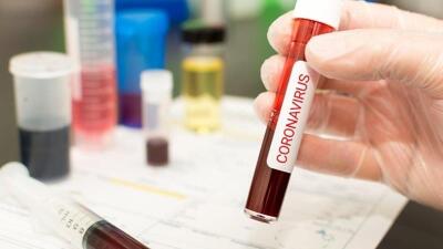 ﻿56 адам коронавирус індетінен емделіп шықты