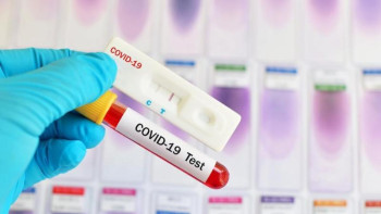 Фотография к новости: Коронавируспен күресу - әрбір адамның борышына айналуы керек – дәрігер 