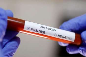 Фотография к новости: МӘМС бойынша ПТР тест кімдерге тегін жасалады?