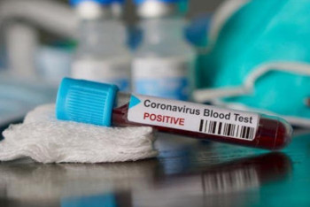 Фотография к новости: Халық сақтық шараларына құлақ аспай отыр – дәрігер