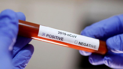 41 адам коронавирус індетінен емделіп шықты