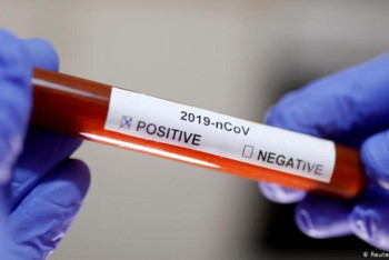 Фотография к новости: Аида Балаева: Әріптестерімнің тезірек сауығып, ұжымға қайта оралуына тілектеспін