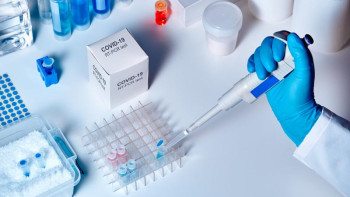 Фотография к новости: Тамызға дейін тәулігіне 39 мың ПТР тест жасалатын болады