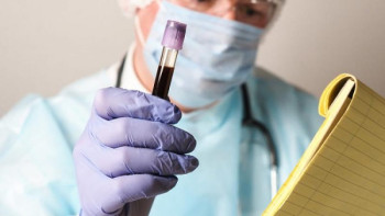 Фотография к новости: COVID-19. Қанша қаражат бөлінді?