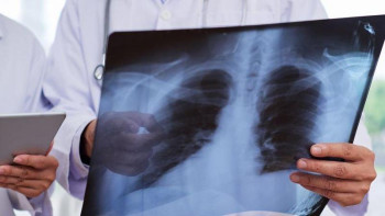 Фотография к новости: Стационарларда 28 мың науқас пневмониядан емделіп жатыр 