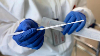 Фотография к новости: Вирус белгісі жоқ науқастар не істеуі керек?