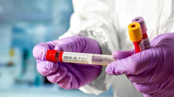 Фотография к новости: Қазір барлығымыз осы індеттің майданындамыз – профессор