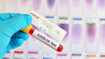 Фотография к новости: Балаева мүмкіндігі шектеулі жандардың жағдайы пандемия кезінде күрделенгенін айтты