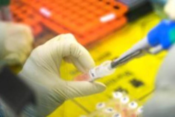 Павлодар облысында ПТР зерттеулерге 90 млн теңгеге жуық қаржы бөлінді 