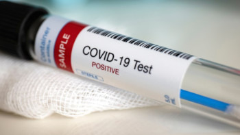 Фотография к новости: Вирустың белгісі жоқ науқастар не істеуі керек?