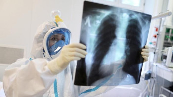 Фотография к новости: Жыл басынан бері пневмониядан 4042 адам қайтыс болған 