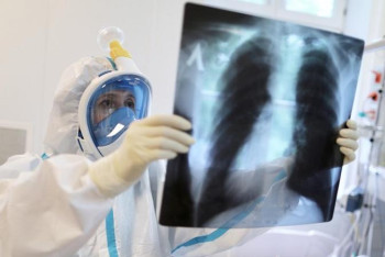 Фотография к новости: Жыл басынан бері пневмониядан 4042 адам қайтыс болған 