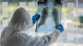 Фотография к новости: Вице-министр КВИ мен пневмония статистикасы неге бөлек айтылғанын түсіндірді 