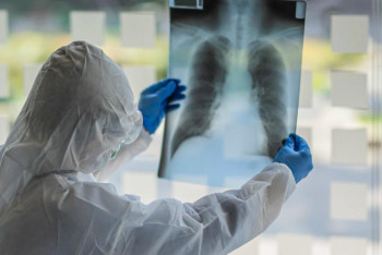 Фотография к новости: Вице-министр КВИ мен пневмония статистикасы неге бөлек айтылғанын түсіндірді 