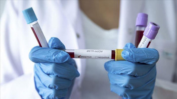 Фотография к новости: Алматыда коронавируспен күреске 27 медицина ұйымы тартылған