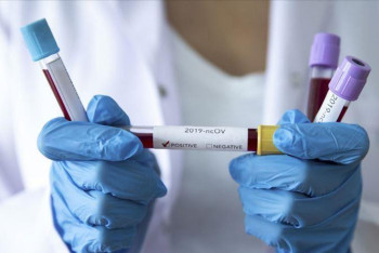 Фотография к новости: Алматыда коронавируспен күреске 27 медицина ұйымы тартылған