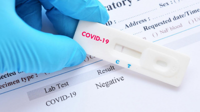 664 адам коронавирус індетінен емделіп шықты