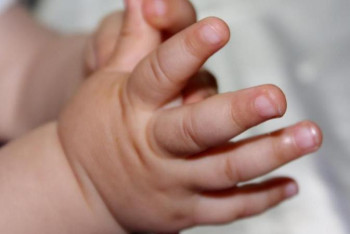 Фотография к новости: Елімізде Кавасаки синдромымен үш бала ауырып жатыр – ДСМ 