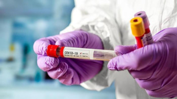 Фотография к новости: Карантин шараларын кезең-кезеңімен алып тастау жоспары