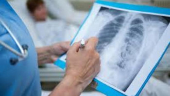 Фотография к новости: Пневмониямен ауырғандар санының күрт өсуіне не себеп?