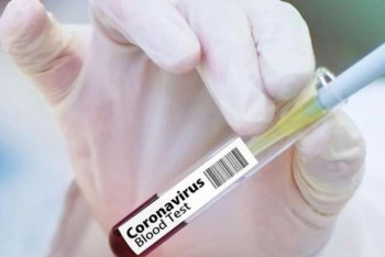 Фотография к новости: Мұғалімдер жұмыста жүріп коронавирус жұқтырса, оларға өтемақы төлене ме?