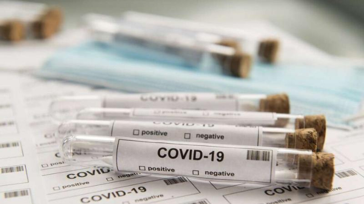 Өткен тәулікте 111 адам коронавирус індетімен ауырғаны белгілі болды