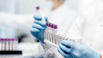 Фотография к новости: Алматыда коронавирус элементтерін анықтайтын PACS жүйесі іске қосылды