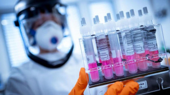 Фотография к новости: Коронавирусқа қарсы іс-шараларға осы күнге дейін қанша қаржы жұмсалды?