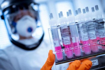 Фотография к новости: Коронавирусқа қарсы іс-шараларға осы күнге дейін қанша қаржы жұмсалды?