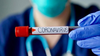 Фотография к новости: Тұмау басталса, оны коронавирустан ажырату қиын болады – ﻿Алмаз Шарман