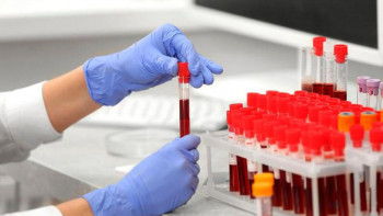 Фотография к новости: Кезекші сыныптардағы 16 баладан коронавирус тіркелді