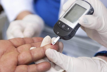 Фотография к новости: Қант диабетін ең алдымен байқайтын дәрігер – стоматолог