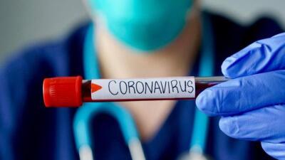 Ғалымдар коронавирусты анықтайтын қағаз тест жасап шығарды 