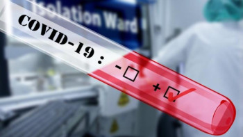 Фотография к новости: COVID-19 инфекциясымен 74 бала ауырып жатыр