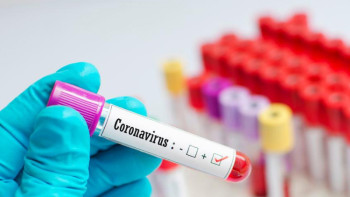 Фотография к новости: Науқас балалармен байланыста болған 29 адам коронавирусқа шалдықты