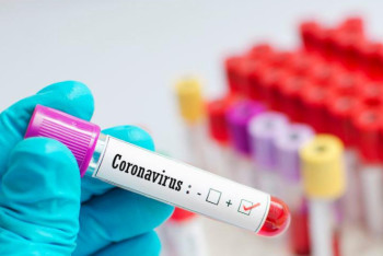 Фотография к новости: Науқас балалармен байланыста болған 29 адам коронавирусқа шалдықты