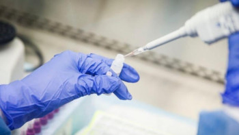 Фотография к новости: ПТР тестілеу құны арзандайды