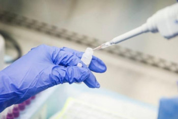 Фотография к новости: ПТР тестілеу құны арзандайды