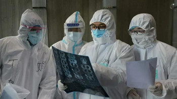 Фотография к новости: Коронавирус жүйке жүйесіне әсер ете ме?