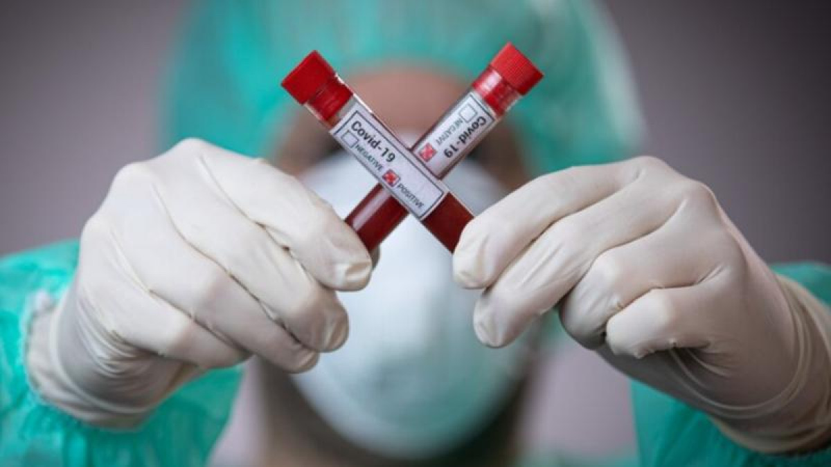 Өткен тәулікте 175 адам коронавирустан емделіп шықты
