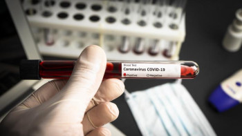 Фотография к новости: Коронавирус онлайн оқитын балаларда көптеп анықталуда 