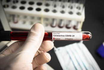 Фотография к новости: Коронавирус онлайн оқитын балаларда көптеп анықталуда 